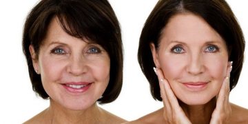 Vücutta Kolajen Nasıl Arttırılır?