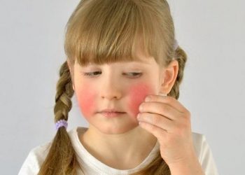 Besin alerjisi farkındalık haftası başladı