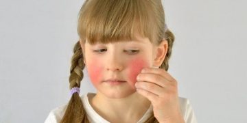 Besin alerjisi farkındalık haftası başladı