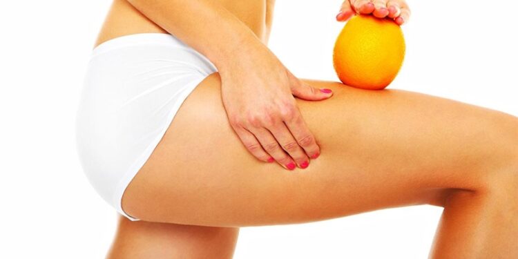 Yaz bitmeden selülitler bitiyor!