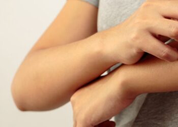 ‘Ütopik’ Değil ‘Ürtiker’!