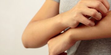 ‘Ütopik’ Değil ‘Ürtiker’!