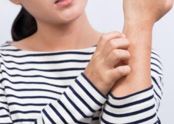 Uzman Dr. Gizem Atakul : Kaşıntı neden olur? Kaşıntıya ne iyi nelir?