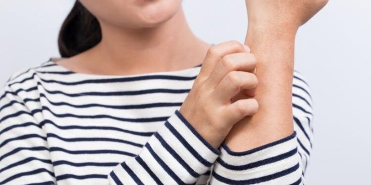 Uzman Dr. Gizem Atakul : Kaşıntı neden olur? Kaşıntıya ne iyi nelir?