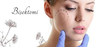 Bişektomi ile Hayal Ettiğiniz Yüz Hatlarına Kavuşun