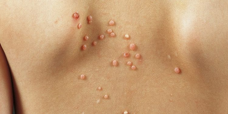 Ezgi Nevçehan : Tatiliniz zehir olmasın