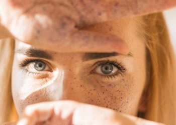 C Vitamini Serumu Güneş Lekelerini Azaltır mı?