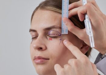 Habibe Topuz: Sarkan göz kapakları, estetik bir ihtiyaç mı, yoksa ciddi bir görme sorunu mu?