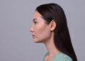 Etnik rinoplastide doğal görünümün önemi