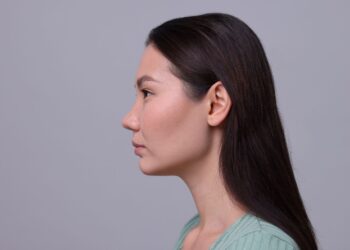 Etnik rinoplastide doğal görünümün önemi