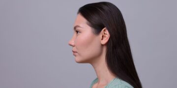 Etnik rinoplastide doğal görünümün önemi