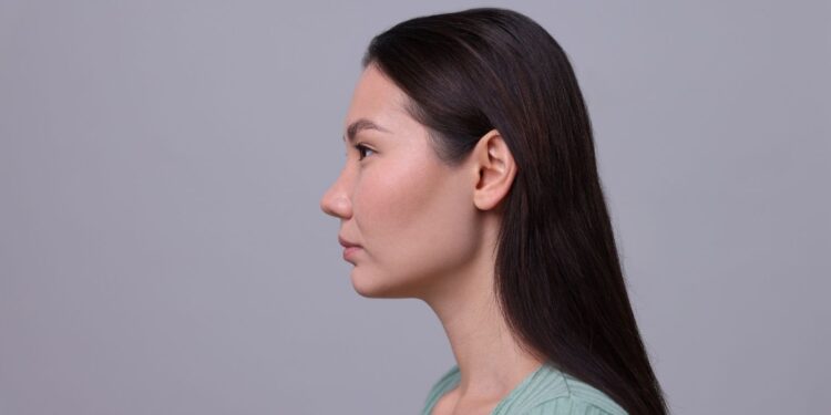 Etnik rinoplastide doğal görünümün önemi